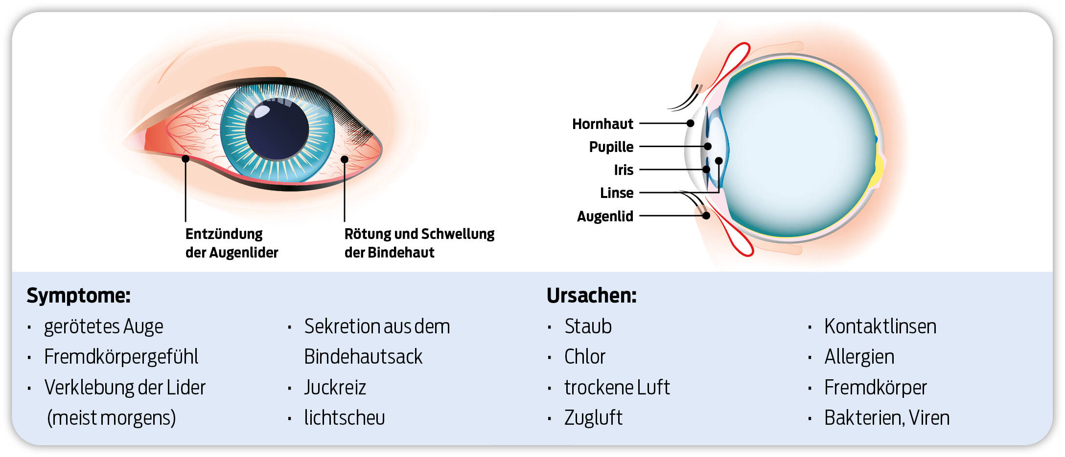 Schlag Aufs Auge Was Tun
